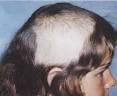 10 Bizarre Diseases You Probably Never Heard Of | Healthmad