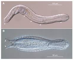 Attēlu rezultāti vaicājumam “Hemitrichia sordivesiculosa macro”