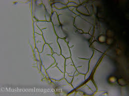 Attēlu rezultāti vaicājumam “Stemonitis lignicola spores”