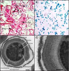 Attēlu rezultāti vaicājumam “Enteridium variabile spores”