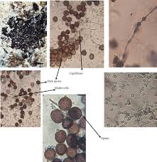 Attēlu rezultāti vaicājumam “Didymium crustaceum spores”