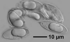 Attēlu rezultāti vaicājumam “Verrucaria hydrela”