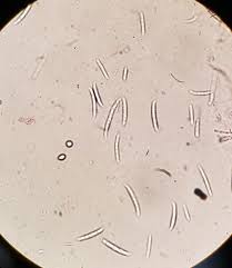Attēlu rezultāti vaicājumam “Didymium verrucisporum spores”
