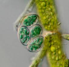 Attēlu rezultāti vaicājumam “Arcyria stipata spores”