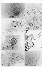 Attēlu rezultāti vaicājumam “Tranzschelia pruni-spinosae spores”