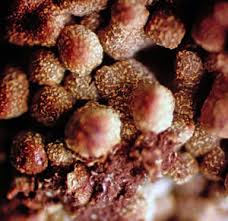 Attēlu rezultāti vaicājumam “Physarum bryomacrocarpum spores”