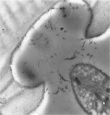 Attēlu rezultāti vaicājumam “Rhodonia placenta”