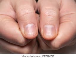 Image result for lunula nail