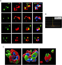 Attēlu rezultāti vaicājumam “Dianema depressum plasmodium”