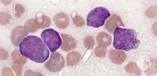 Attēlu rezultāti vaicājumam “Pseudobryum cinclidioides cells”