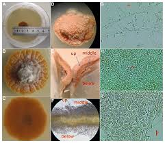 Attēlu rezultāti vaicājumam “Stemonitopsis aequalis var. microspora spores”
