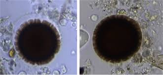 Attēlu rezultāti vaicājumam “Fuligo laevis spores”