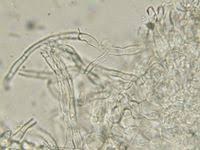 Attēlu rezultāti vaicājumam “Hyalorbilia inflatula”