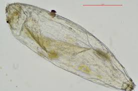Attēlu rezultāti vaicājumam “Oxyrrhynchium hians var. rigidum macro”