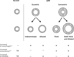 Image result for  ^ L V [ h    