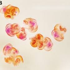 Attēlu rezultāti vaicājumam “Frullania dilatata”