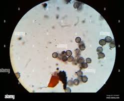 Attēlu rezultāti vaicājumam “Physarum psittacinum”