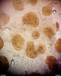 Attēlu rezultāti vaicājumam “Lycogala fuscoolearium macro”