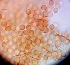 Attēlu rezultāti vaicājumam “Tubifera magna”