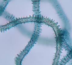 Attēlu rezultāti vaicājumam “Heterotrichia obvelata (syn. Arcyria obvelata) young”