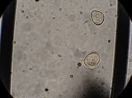 Attēlu rezultāti vaicājumam “Reticularia lobata young”