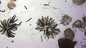 Attēlu rezultāti vaicājumam “Sordaria fimicola”