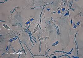 Attēlu rezultāti vaicājumam “Biatora sphaeroides”