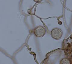Attēlu rezultāti vaicājumam “Clastoderma debaryanum spores”