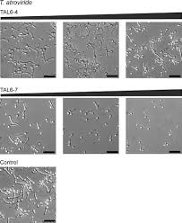 Attēlu rezultāti vaicājumam “Enteridium liceoides spores”