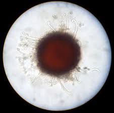 Attēlu rezultāti vaicājumam “Sawadaea tulasnei”