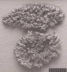 Attēlu rezultāti vaicājumam “Arthonia leucopellaea”