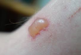 Image result for Diptam