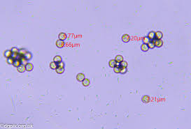 Attēlu rezultāti vaicājumam “Cribraria rubiginosa spores”