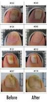 Image result for lunula nail