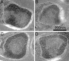 Attēlu rezultāti vaicājumam “Enteridium variabile plasmodium”
