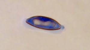 Attēlu rezultāti vaicājumam “Diderma ochraceum sessile”