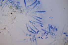 Attēlu rezultāti vaicājumam “Nectria episphaeria”