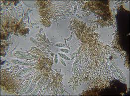 Attēlu rezultāti vaicājumam “Alyxoria varia”