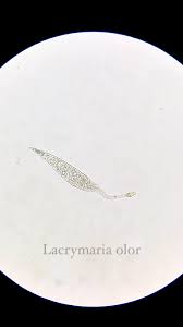 Attēlu rezultāti vaicājumam “Didymium clavus spores”