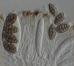 Attēlu rezultāti vaicājumam “Diachea muscorum spores”