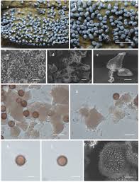 Attēlu rezultāti vaicājumam “Physarum bryomacrocarpum spores”