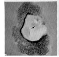 Attēlu rezultāti vaicājumam “Didymium nigripes young”