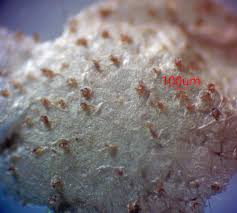 Attēlu rezultāti vaicājumam “Lycogala cf. oleocrystalliferum”