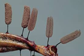 Attēlu rezultāti vaicājumam “Stemonitopsis aequalis var. microspora spores”