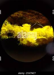 Attēlu rezultāti vaicājumam “Oligonema favogineum”