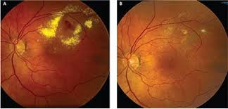 Attēlu rezultāti vaicājumam “Reticularia jurana macro”