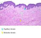 reticular layer of the <b>dermis</b>