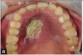 2009/03/post-c2ad.html에 대한 이미지 검색결과