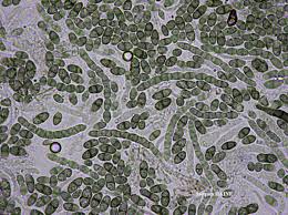 Attēlu rezultāti vaicājumam “Calicium salicinum”
