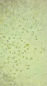 Attēlu rezultāti vaicājumam “Gloeocapsa rupestris”